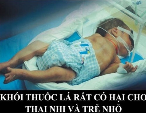 Hút một điếu thuốc có hại bằng một lần chụp X-quang