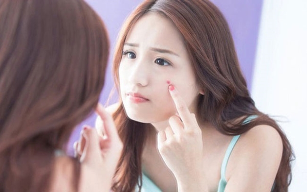 Tuổi dậy thì có nên dùng serum trị mụn không